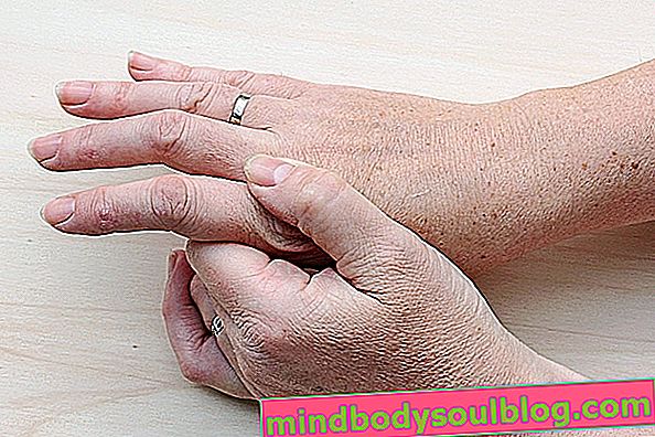 ארתרוזיס בידיים: תסמינים, סיבות וטיפול
