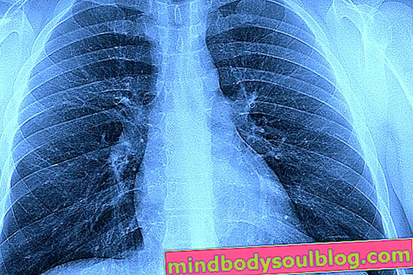 肺の主な水の症状、原因、および治療方法