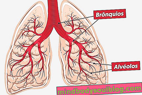 気管支肺炎とは何ですか？