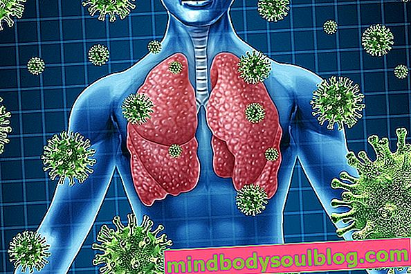Infeksi paru-paru: apa itu, penyebab dan jenis utama