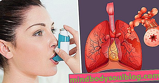 Asthmatische Bronchitis: Was es ist, Symptome und Behandlung