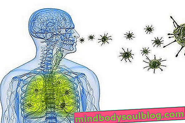 דלקת ריאות חיידקית: תסמינים, העברה וטיפול