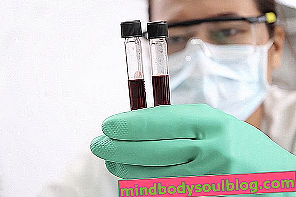 Гази артеріальної крові: що це таке, для чого він призначений та контрольні значення