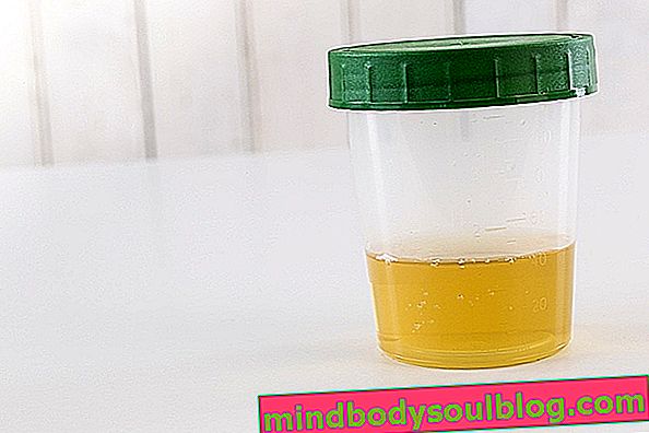 Apa kultur urin dengan antibiogram, bagaimana cara melakukannya dan untuk apa