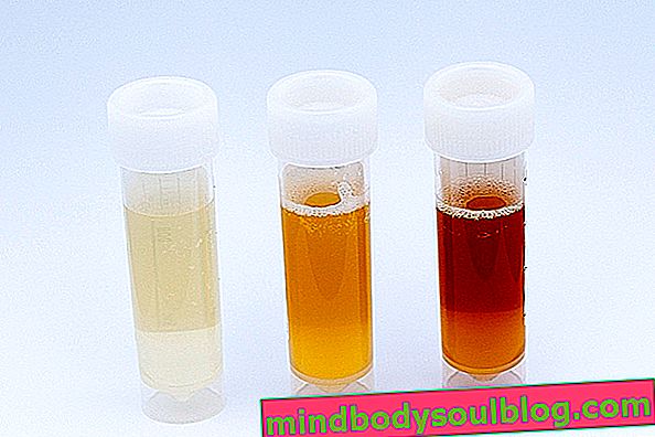 Sel darah merah dalam urin: apa artinya dan bagaimana mengobatinya