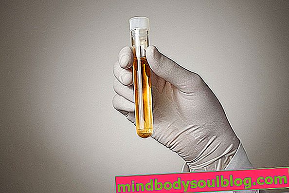 Мазнини в урината: какво може да бъде и какво да правя