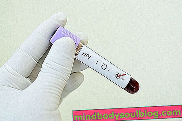 فهم نتائج اختبار فيروس نقص المناعة البشرية