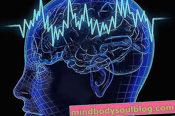 脳波とは何か、どのように準備するか