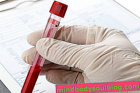 Comment comprendre le test sanguin