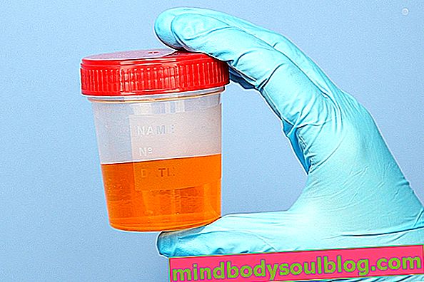 Que signifie la bilirubine dans l'urine et que faire