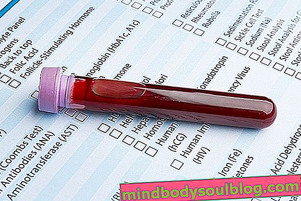Quel est le RDW élevé ou faible dans le test sanguin