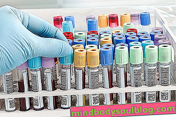 Test de phosphore sanguin: comment procéder et valeurs de référence
