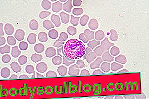 血液サンプル中の好酸球