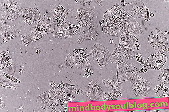 Епителни клетки в урината: какво може да бъде и как да се разбере тестът