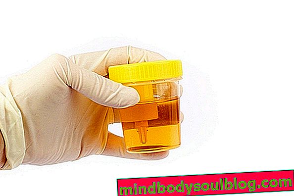 Nitrite positif dans l'urine: ce que cela signifie et comment le test est effectué
