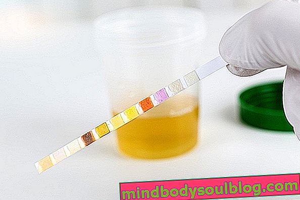 Test d'urine EAS: à quoi ça sert, préparation et résultats