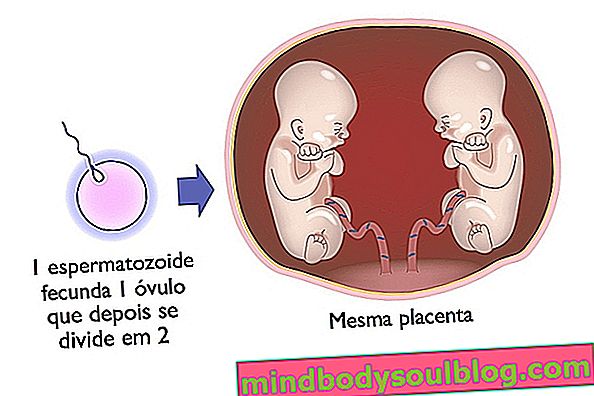 Как да забременея с близнаци