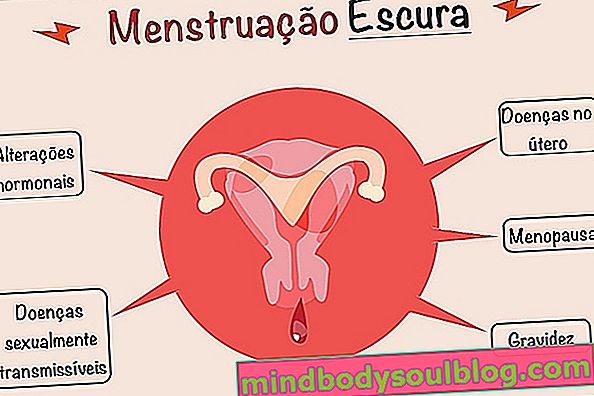 Dunkle Menstruation: 6 Ursachen und wann Sie sich Sorgen machen müssen