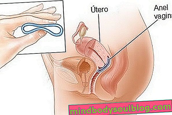 9 най-често срещани въпроса за използването на вагиналния пръстен