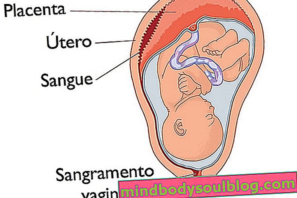 Placenta: qu'est-ce que c'est, à quoi ça sert et principaux problèmes