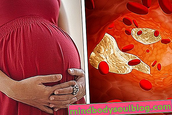 Taux de cholestérol élevé pendant la grossesse