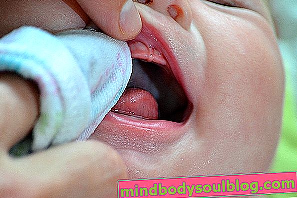 איך מנקים את לשון התינוק