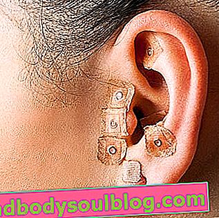 耳介療法：それが何であるか、それが何であるか、および主なポイント