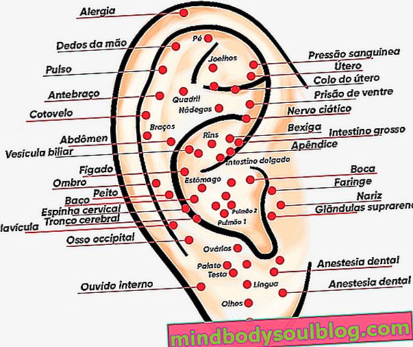耳介療法：それが何であるか、それが何であるか、および主なポイント