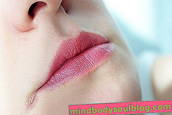 Przyczyny i leczenie ustnika (ból w kąciku ust)
