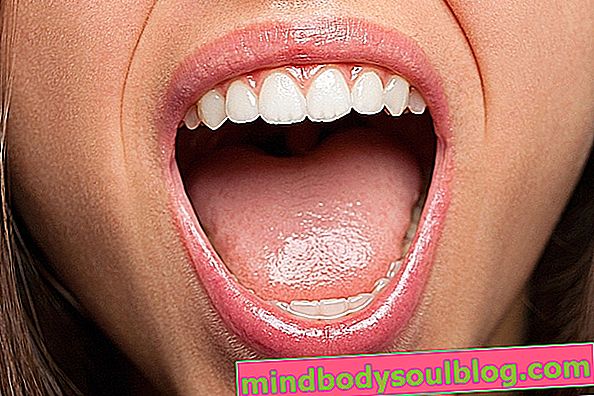 Какво представлява кандидозата на устната кухина, симптоми и как да се лекува