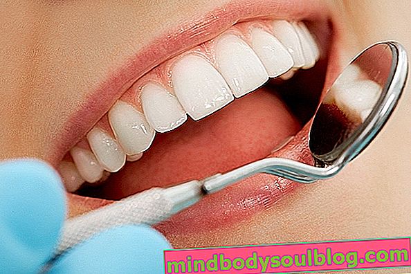 4 opcje leczenia wybielania zębów