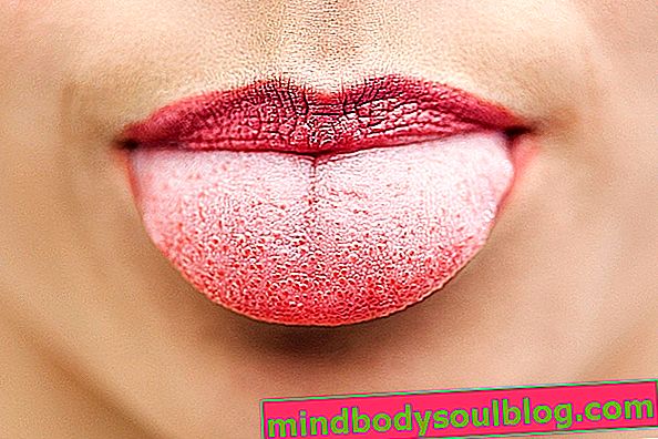 Bintik di lidah: apa yang bisa dan apa yang harus dilakukan