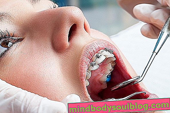 ประเภทของความผิดปกติของฟันและวิธีการรักษา