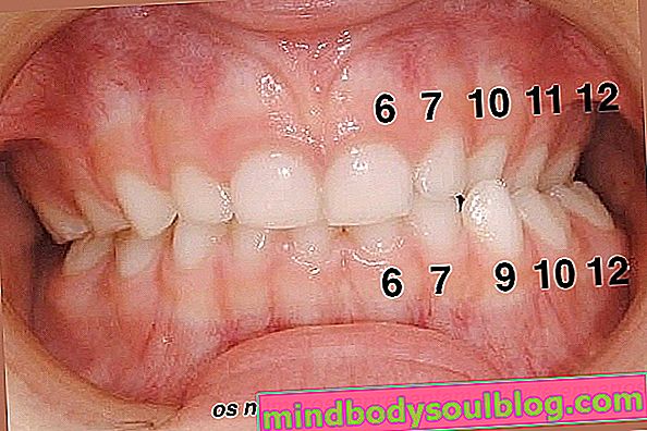 Ile czasu zajmuje ząb (i co zrobić, jeśli to trwa)