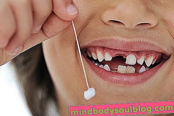 歯にはどれくらいの時間がかかりますか？