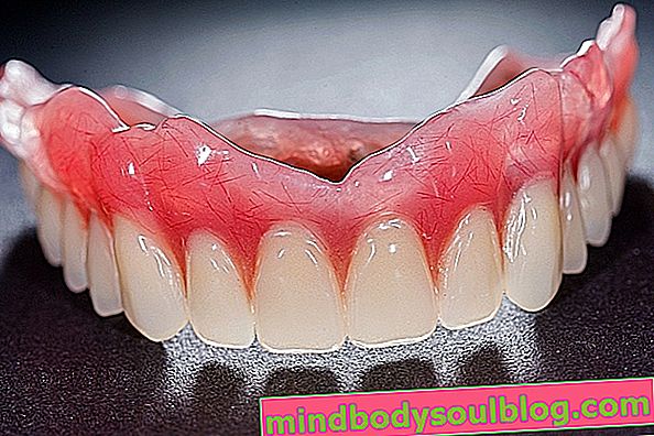 Видове зъбни протези и как да се грижим