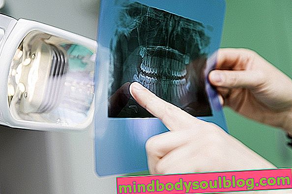 歯質嚢胞-それは何であり、どのように行われるか