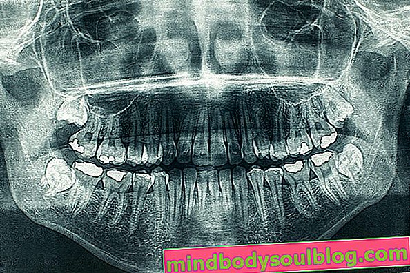 Panoramiczne zdjęcie rentgenowskie jamy ustnej (ortopantomografia): do czego służy i jak się to robi