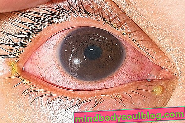 Tetes mata untuk konjungtivitis, pelumas, anti alergi dan anti inflamasi