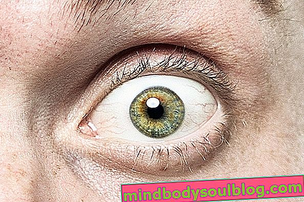 7 changements oculaires pouvant indiquer une maladie