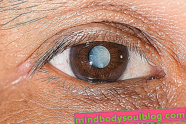 7 changements oculaires pouvant indiquer une maladie