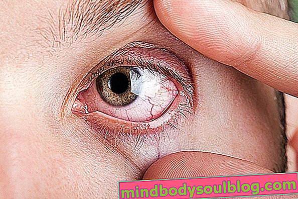 Как да премахнете петънцето от окото