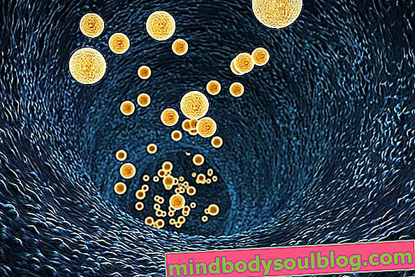 5 cara alami untuk melawan rinitis alergi