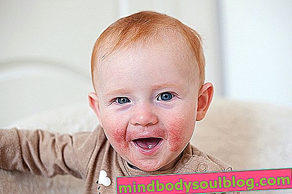 Taches rouges sur le bébé: ce qui peut être et comment traiter
