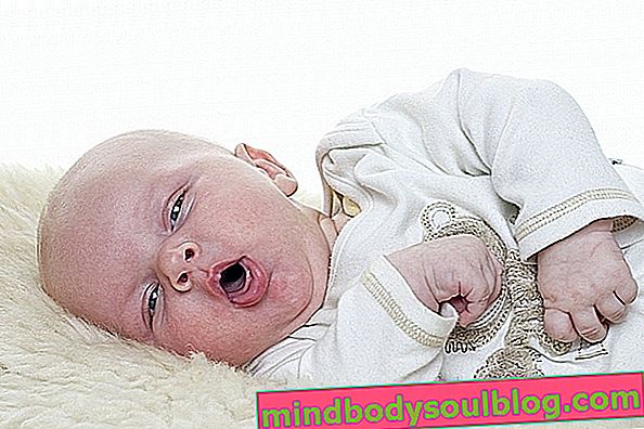 赤ちゃんシズラー症候群とは何ですか？