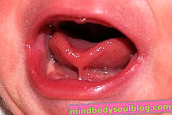 Wie Sie feststellen können, ob Ihr Baby eine Zunge hat