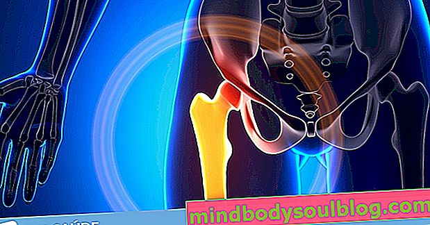 Douleur à la hanche: 6 causes courantes et que faire
