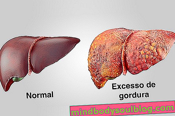 脂肪肝：症状、程度、原因および治療