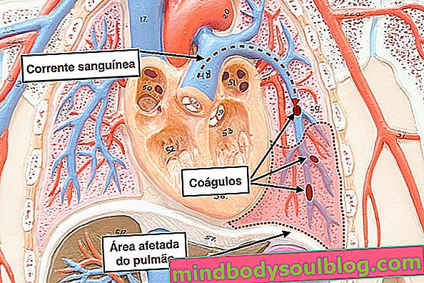 肺の痛み：6つの主な原因と対処法