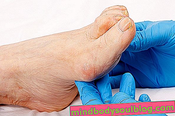 足と足首の腫れ：10の主な原因と対処法